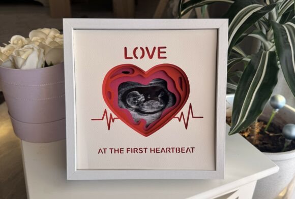 Ultrasound Photo Frame - 3D SVG Shadow Box for Content Creators